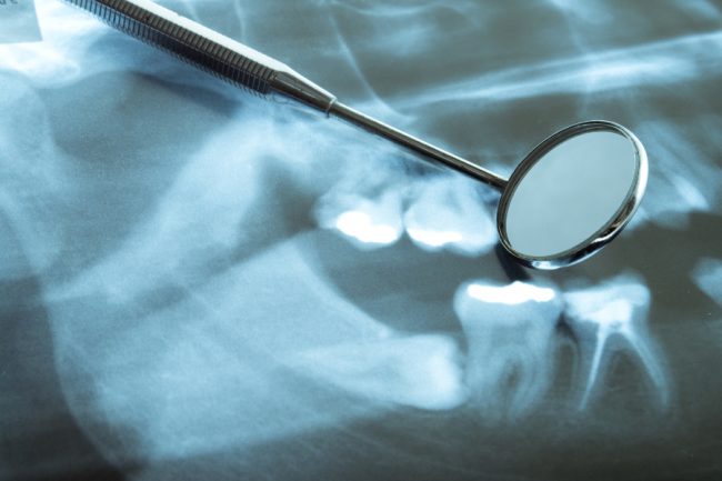 030601_Endodontie_featured_900x600